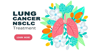 Empower Your Fight: Discover Breakthrough Immunotherapy for Non Small Cell Lung Cancer