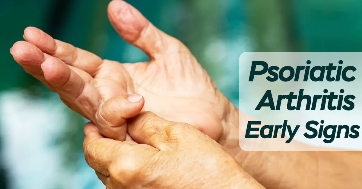 What are the Early Signs of Psoriatic Arthritis?