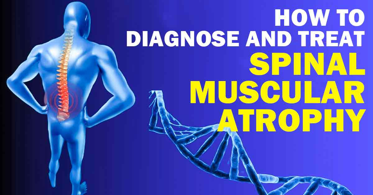 How to Diagnose and Treat SMA?