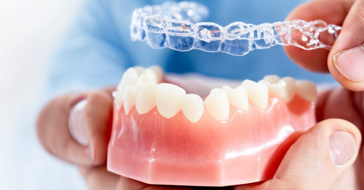 Finding the Perfect Nearby Invisible Dental Aligners Dentist
