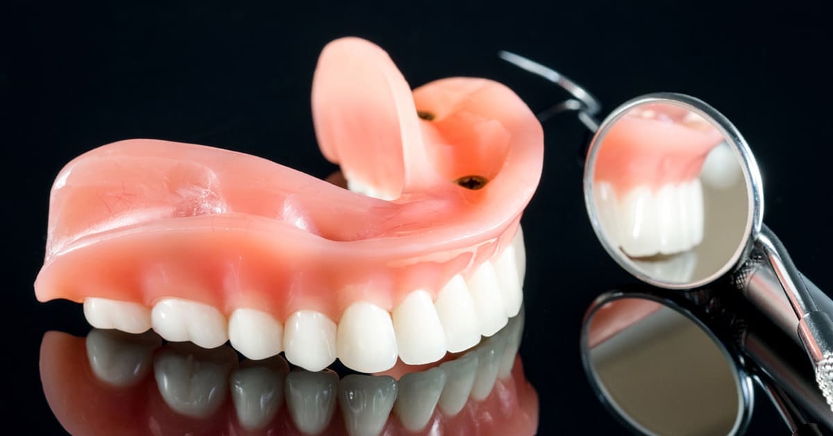 Seniors: Full Mouth Dental Implants For An Unbeatable Price