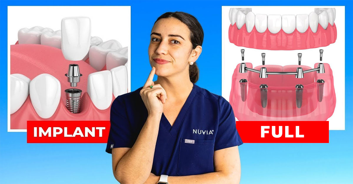 高齢者向けの安価な歯科インプラント