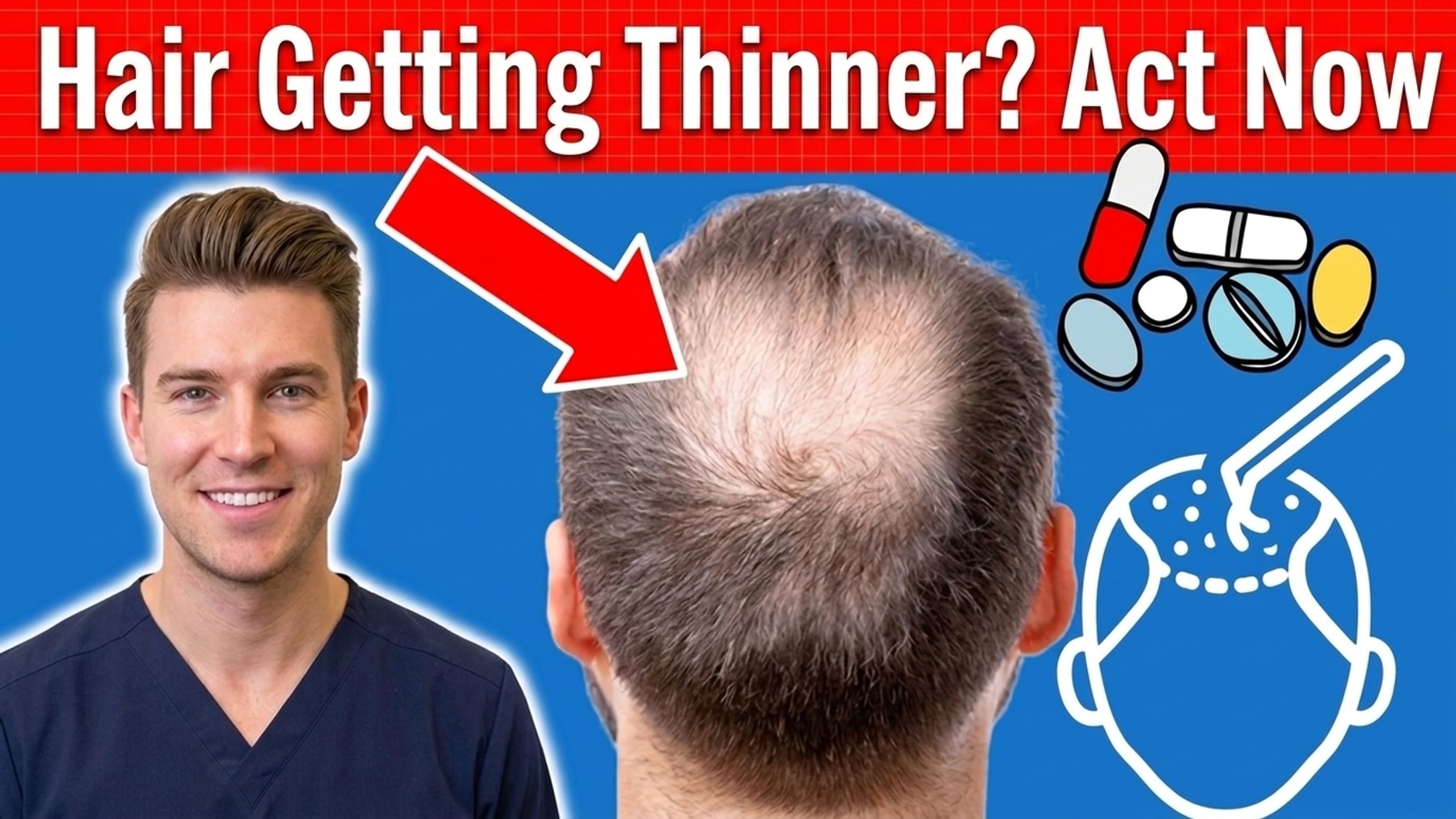 もう手遅れ？薄毛の悩みを今すぐ解決