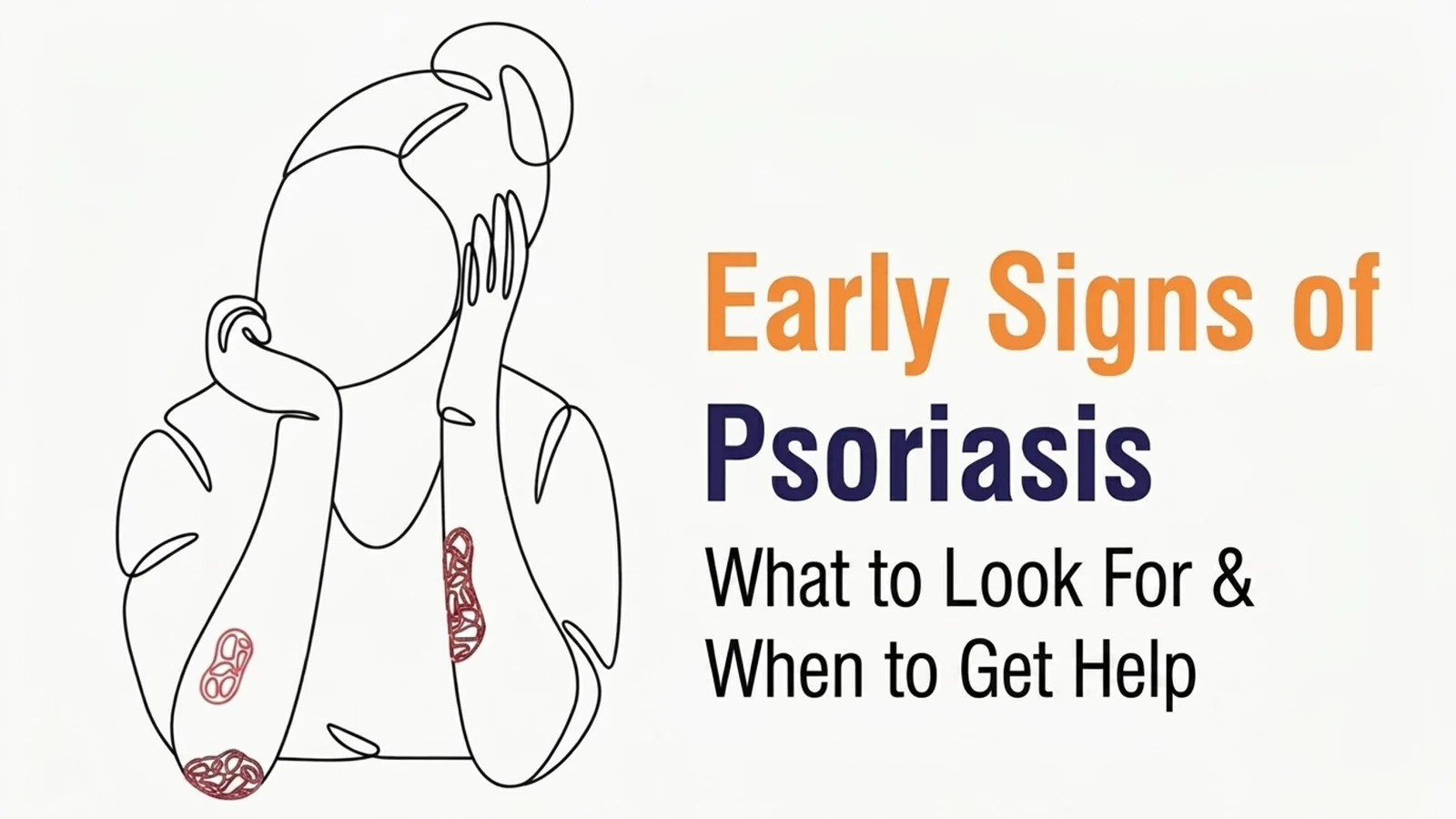 尋常性乾癬：症状と治療法の特定