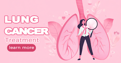 Latest Treatment Guidelines for Non-Small Cell Lung Cancer