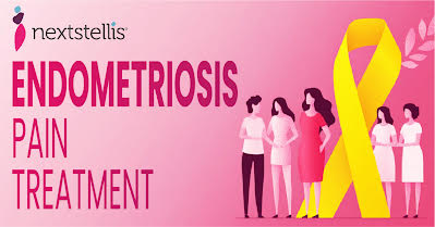Endometriosis Pain? Take the Quick Relief Drug - Recommended By Authoritative Experts